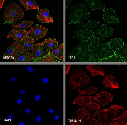 IRP2 Recombinant Rabbit mAb (S-4592-56)