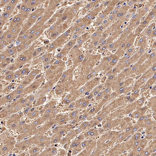 Ferritin Light Chain Recombinant Rabbit mAb (S-1879-19)