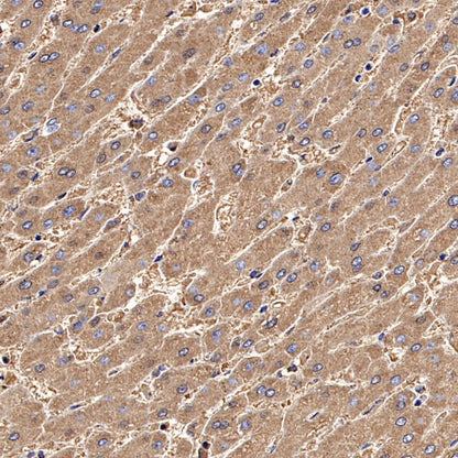 Ferritin Light Chain Recombinant Rabbit mAb (S-1879-19)