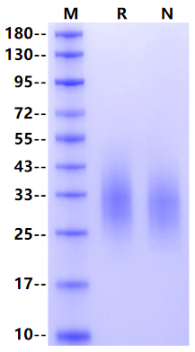 CD300a/LMIR1 His Tag Protein, Human