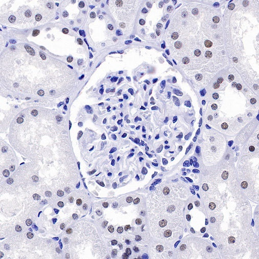 S-RMab® PMS2 Recombinant Rabbit mAb (SDT-R460)