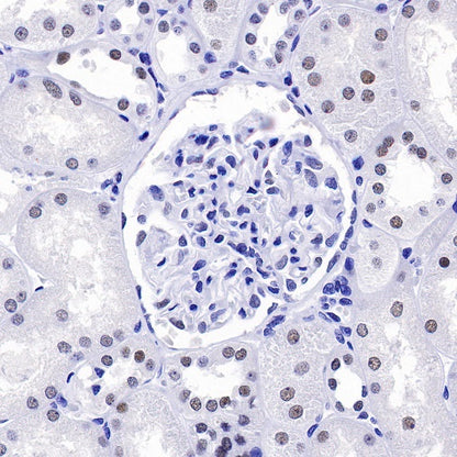 S-RMab® PMS2 Recombinant Rabbit mAb (SDT-R460)