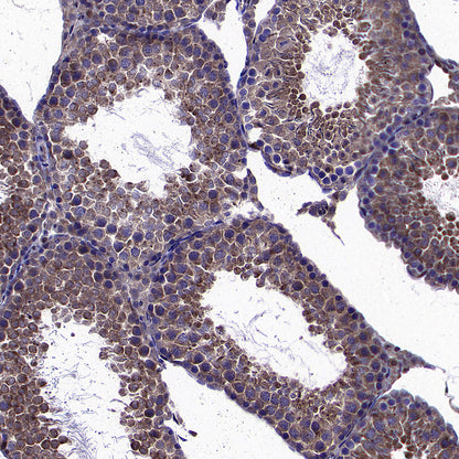IRF3 Recombinant Rabbit mAb (S-3916-22)