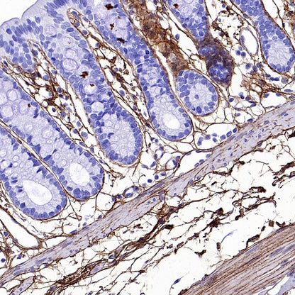 Collagen III Recombinant Mouse mAb (S-3838)