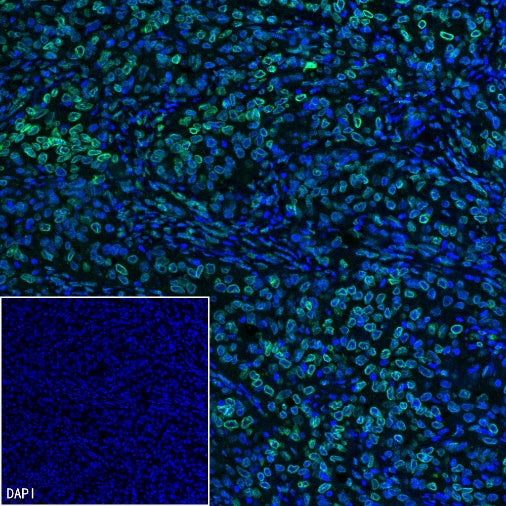 SREBP2 Recombinant Rabbit mAb (S-2701-1)