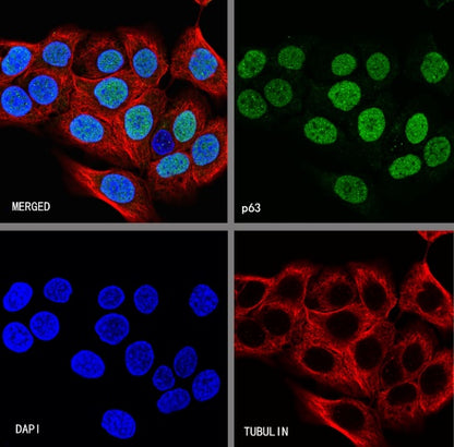 p63 Recombinant Rabbit mAb (SDT-054-137)