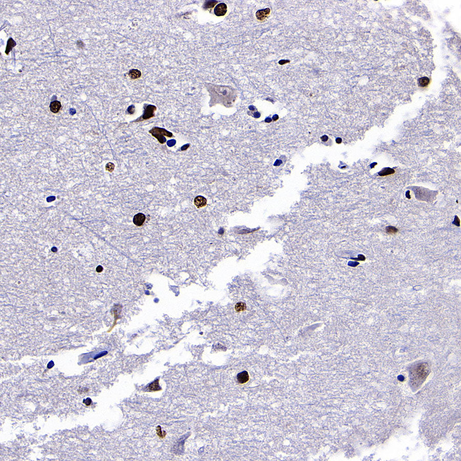 ZMYND8 Recombinant Rabbit mAb (S-5407)
