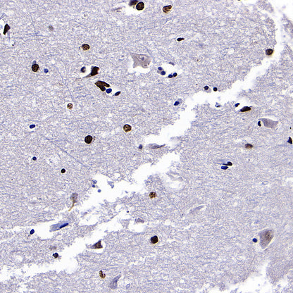 ZMYND8 Recombinant Rabbit mAb (S-5407)