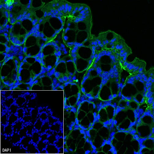 Integrin beta 4 Recombinant Rabbit mAb (S-1625-170)