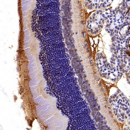 CRALBP Rabbit Polyclonal Antibody