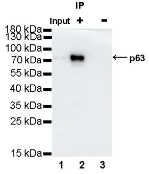 p63 Recombinant Rabbit mAb (SDT-054-137)