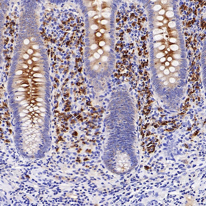 Human IgA1 Rabbit Polyclonal Antibody