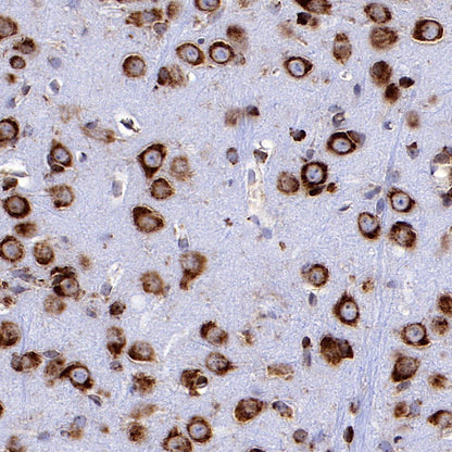 BID Recombinant Rabbit mAb (S-R300)