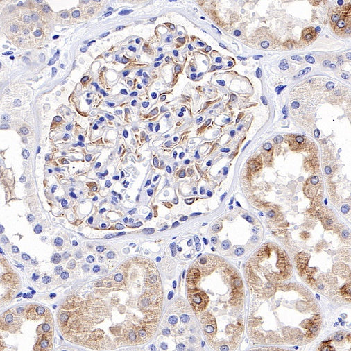 Beta II tubulin Rabbit polyclonal antibody