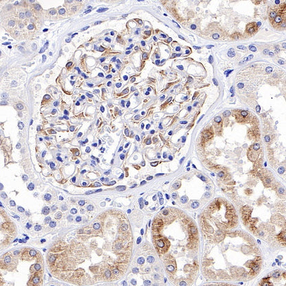 Beta II tubulin Rabbit polyclonal antibody