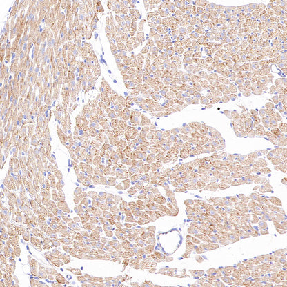 NDUFB8 Recombinant Rabbit mAb (S-4770-29)
