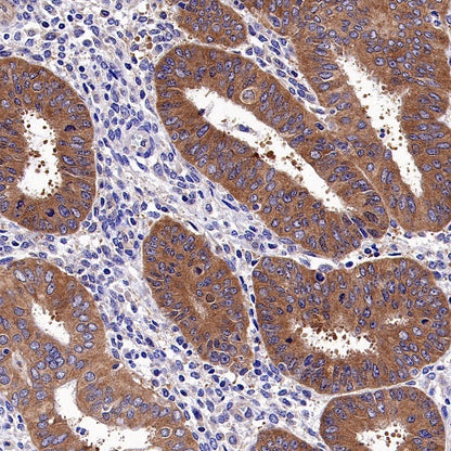 IDE Recombinant Rabbit mAb (S-1051-61)