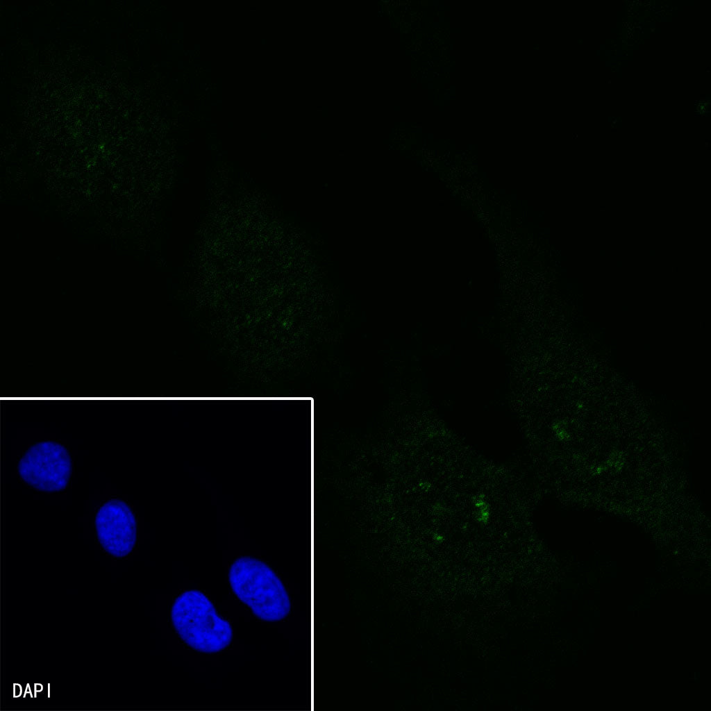 GPNMB Recombinant Rabbit mAb (S-491-6)