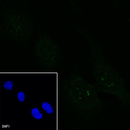 GPNMB Recombinant Rabbit mAb (S-491-6)