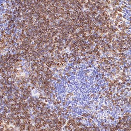 Rat Anti-Mouse CD45R/B220 Antibody (RA3-6B2)