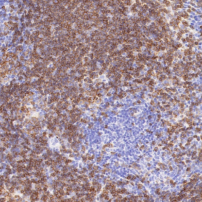 Rat Anti-Mouse CD45R/B220 Antibody (RA3-6B2)