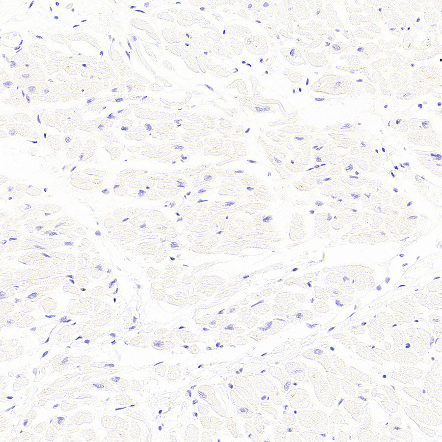 AK1C3 Rabbit Polyclonal Antibody
