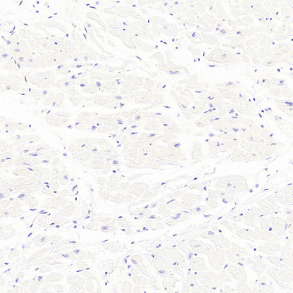 AK1C3 Rabbit Polyclonal Antibody