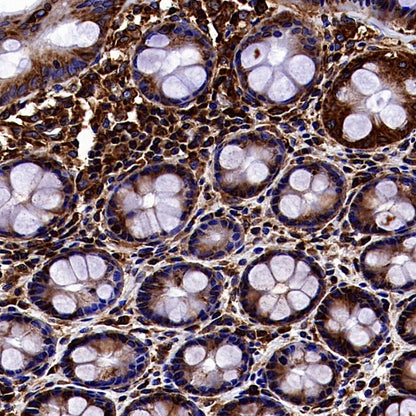YB1 Recombinant Rabbit mAb (S-1748-144)