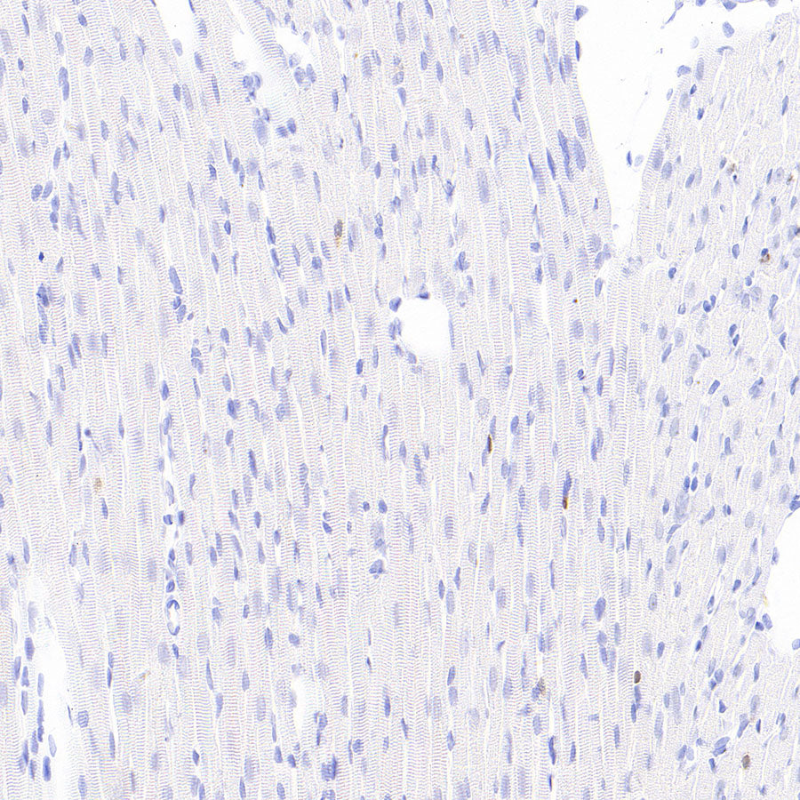 Stat4 Recombinant Rabbit mAb (S-4916-70)