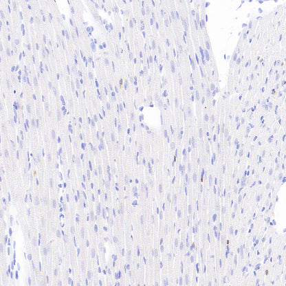 Stat4 Recombinant Rabbit mAb (S-4916-70)