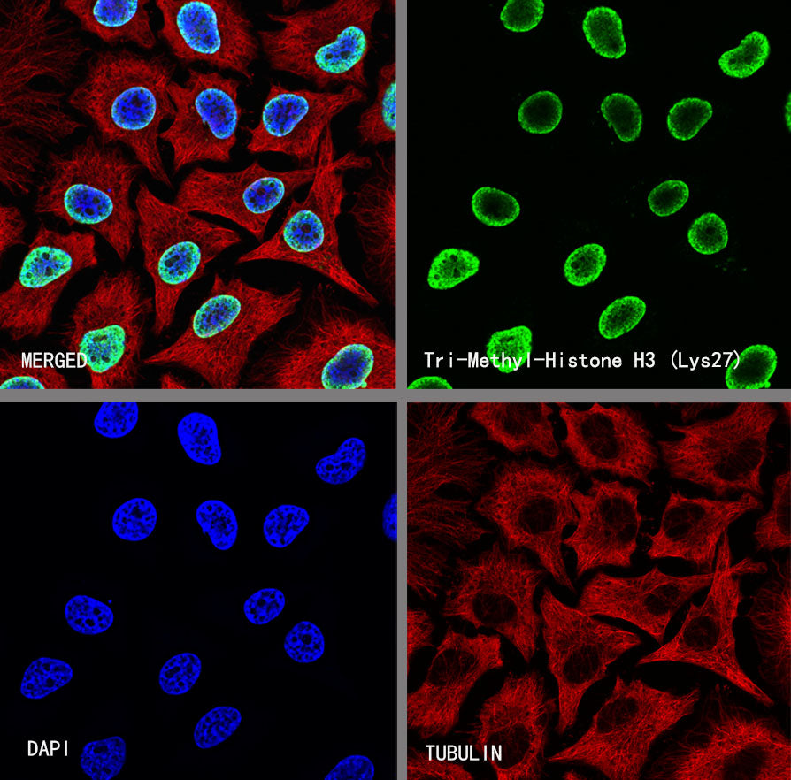 Histone H3 (tri methyl K27) Recombinant Rabbit mAb (S-4331)