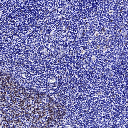 FoxO3a Recombinant Rabbit mAb (S-465-41)