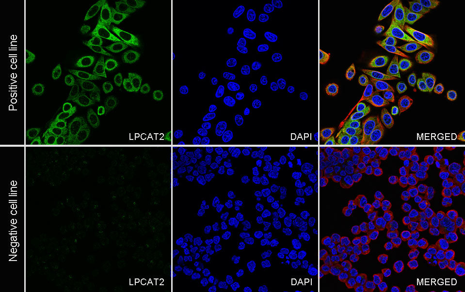 LPCAT2 Recombinant Rabbit mAb (S-4239-18)