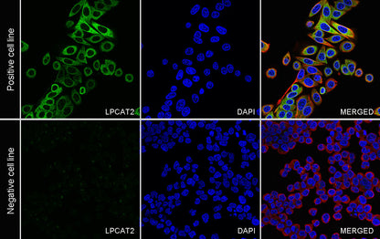 LPCAT2 Recombinant Rabbit mAb (S-4239-18)