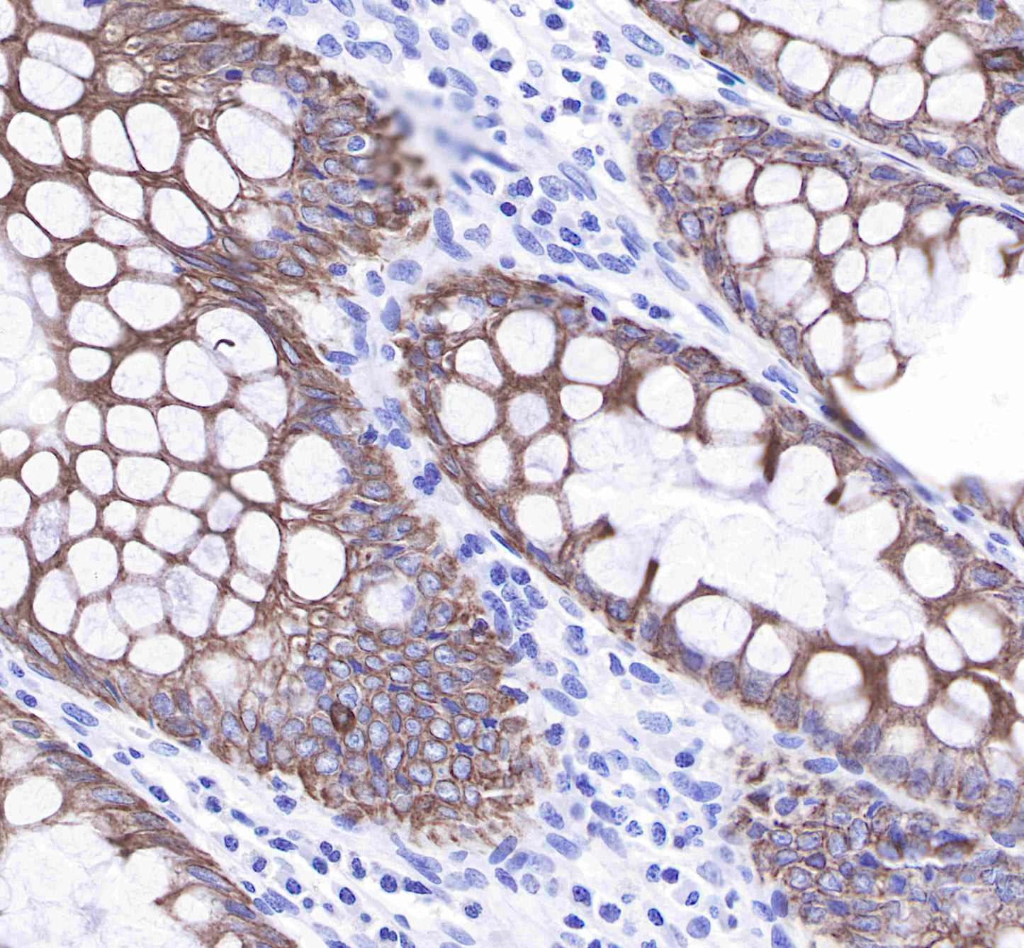 Keratin 8 Recombinant Rabbit mAb,PBS Only (SDT-016-46)