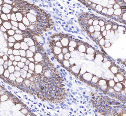 Keratin 8 Recombinant Rabbit mAb,PBS Only (SDT-016-46)