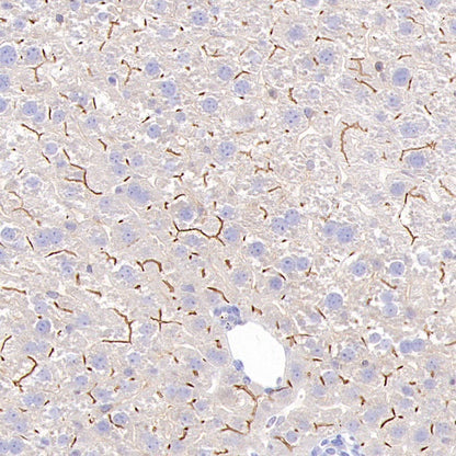 MDR3 Recombinant Rabbit mAb (SDT-1949-60)
