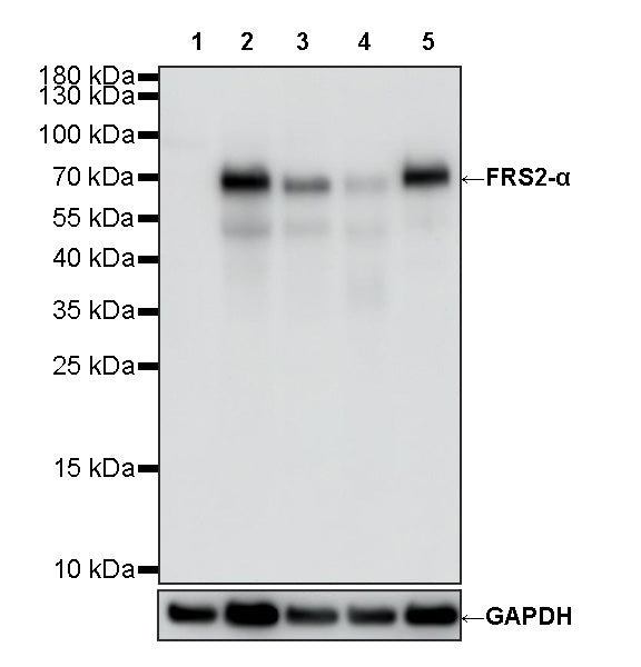 FRS2-α Recombinant Rabbit mAb (S-4065-59)