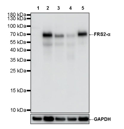 FRS2-α Recombinant Rabbit mAb (S-4065-59)