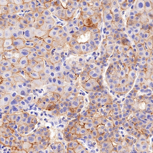 Claudin 1 Recombinant Rabbit mAb (SDT-1289-55)