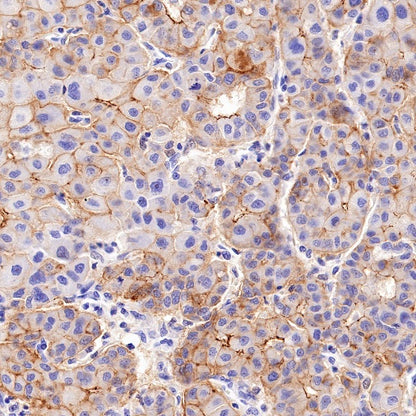 Claudin 1 Recombinant Rabbit mAb (SDT-1289-55)