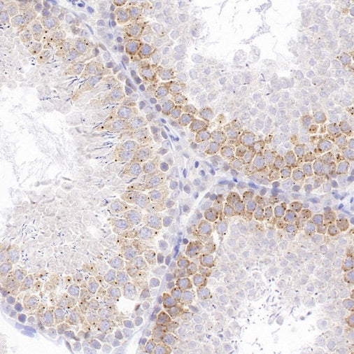 RNF17 Recombinant Rabbit mAb (S-3660-61)