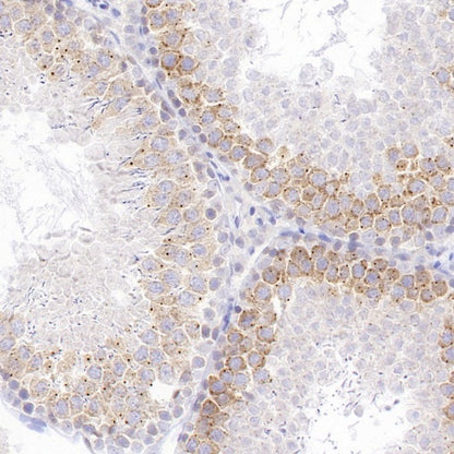 RNF17 Recombinant Rabbit mAb (S-3660-61)