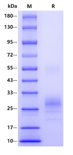 IL-7 His Tag Protein,Human