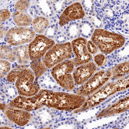 IFIT1 Recombinant Rabbit mAb (S-962-58)