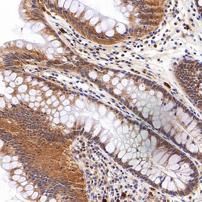 IFIH1 Recombinant Rabbit mAb (S-2413-49)