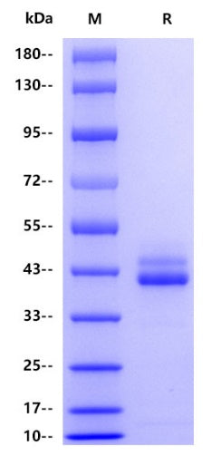 IL-12B(p40) His Tag Protein, Human