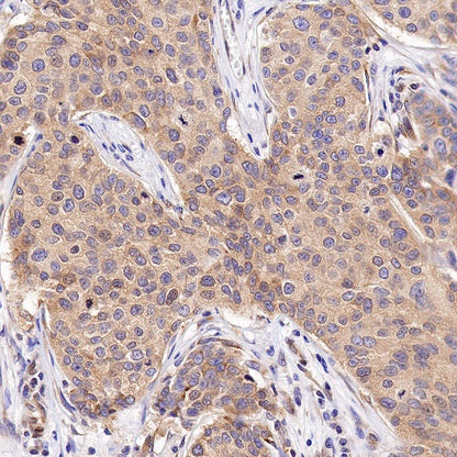Argonaute-2 Recombinant Rabbit mAb (S-1826-47)