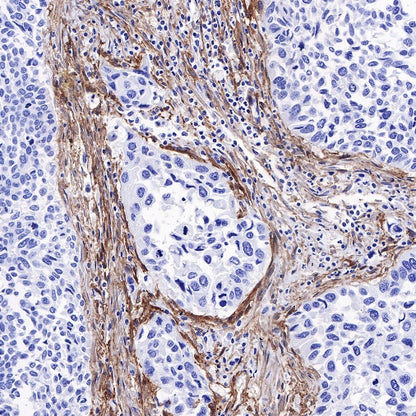 PDGFRA+PDGFRB Recombinant Rabbit mAb (S-393-11)