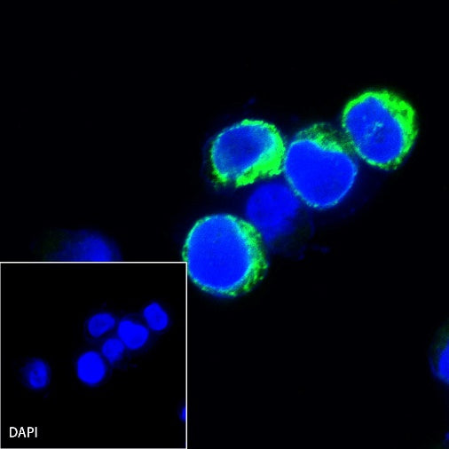 Kappa light chain Recombinant Rabbit mAb (S-385-23)